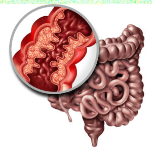 Functional Medicine