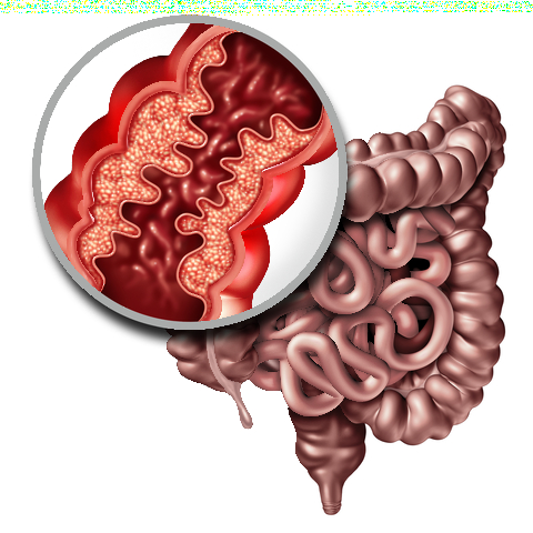 Functional Medicine