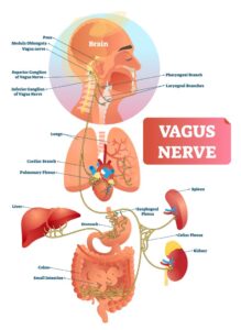 Vagus Nerve Syndrome